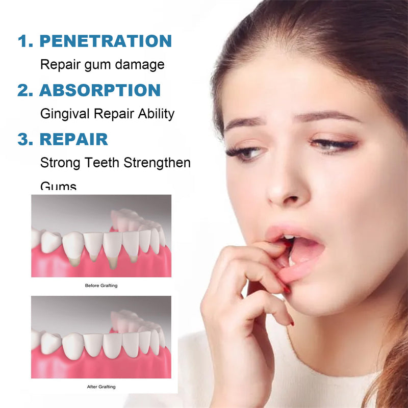 Rapid Repair Gums Serum – Tooth Sensitivity & Damage Relief